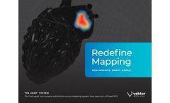 vMap - Advanced Arrhythmia Redefine Mapping Tool - Brochure