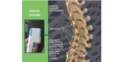 Dynamic Scoliosis Tethering System