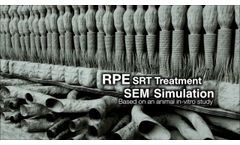 R:GEN SRT RPE Treatment - Video