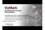 VizMark | Macromolecular Biopsy Tissue Marker - Video