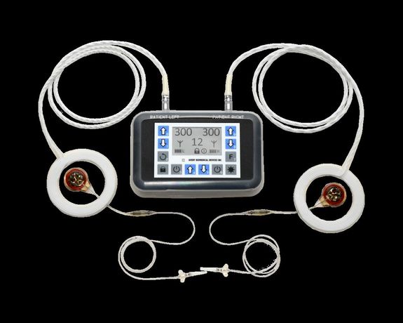 Avery - Diaphragm Pacing System