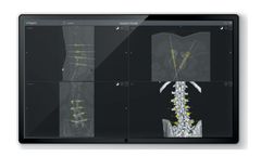 Fiagon - Version VirtuSuite - SPINE Navigation Software