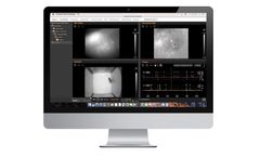 Inscopix - Software Solutions for Miniscope Imaging
