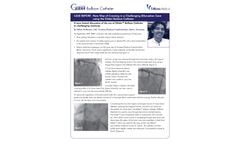 Glider - Model PTCA - Balloon Catheter Clinical Case Studies - Brochure