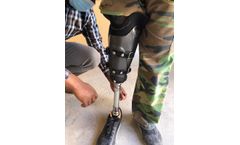 IFIT Helps Persons with Limb Loss in Botswana