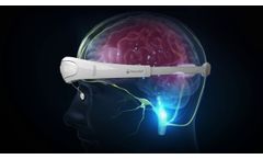 Relivion Brain Neuromodulation - How it works - Video