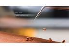 Navigation Medical Sensor Technology