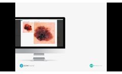 DermEngine for Intelligent Dermatology - Video