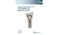 GEMINUS Distal Radius System Surgical Brochure