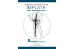 IMPLATE - Wrist Arthrodesis Nail Surgical - Technique Guide