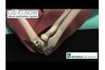 IJS?? Elbow Stabilization System Animation - Video