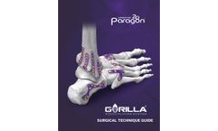 Gorilla R3con Plating System Surgical - Technique Guide