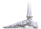 APEX 3D - Total Ankle Replacement System