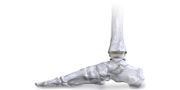 Total Ankle Replacement System