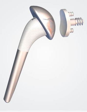Humeris Anatomical - Primary Convertible Shoulder Prosthesis