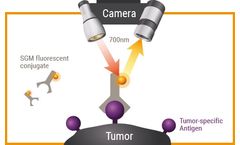SurgiMab - Intraoperative Detection Technology of Tumors