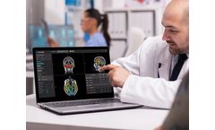 QyScore - Groundbreaking Neuroimaging Analysis Platform Software