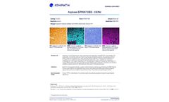 Ionpath - Model 150Nd - Arginase-1 Antibody  - Brochure