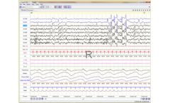 Cleveland - PSG and Home Sleep Study Scoring Software