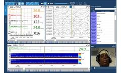 Moberg - Version CNS Envision - CNS Reader Software