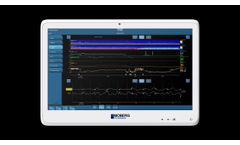 CNS Monitor - Video