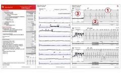 Bardy - Carnation Ambulatory Monitor (CAM) Report Software