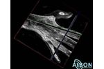 aiSon 3D - Ultrasound Device