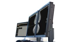 Medical Scientific - Model DIARM DM - Mammography Workstation