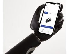 FAQs About Bionic Hands: Answered