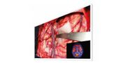 55-Inch Widescreen Surgical Monitor
