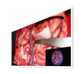 CuratOR - Model EX5542 - 55-Inch Widescreen Surgical Monitor