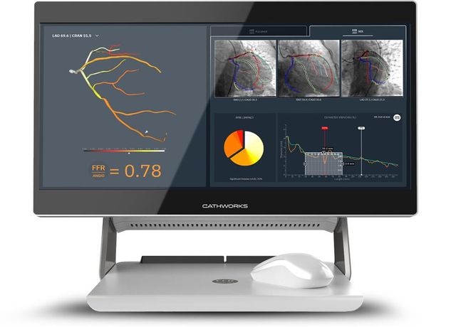 CathWorks FFRangio - Advanced Angiograms System
