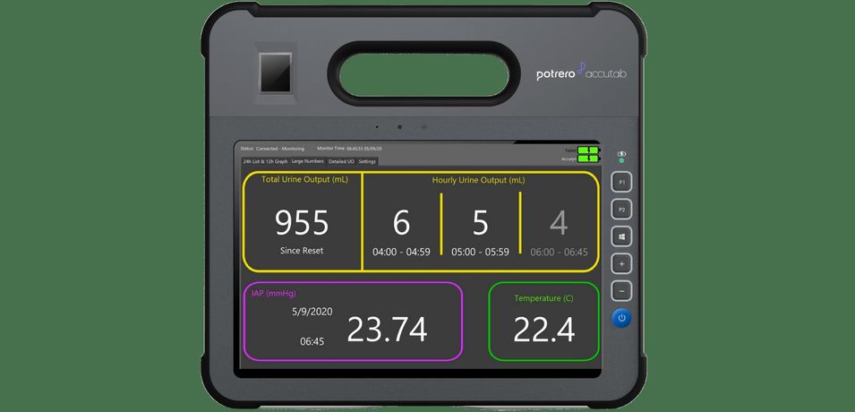 Potrero AccuTab - Monitor of Key Vitals