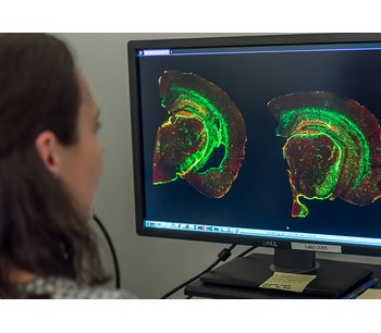 Alkahest - Model GRF6019 & GRF6021 - Selected Plasma Fractions Cell