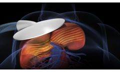 MRE Magnetic Resonance Elastography - Mayo Clinic - Video