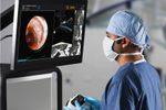 Robotic-Assisted Bronchoscopy System for Lung Cancer Statistics - Medical / Health Care