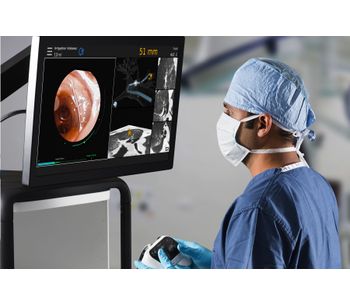 Robotic-Assisted Bronchoscopy System for Lung Cancer Statistics - Medical / Health Care
