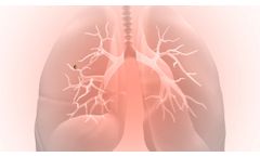 Robotic-Assisted Bronchoscopy System for Lung Nodules