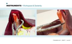 SPORT Surgical System (Development Update on Titan Medical`s Robotic Surgery system)- Video