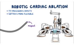 What is Stereotaxis Robotic Ablation for Cardiac Arrhythmia? - Video