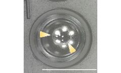 Acoustic Bioprinter for In Vitro Vascularization Controlled by Local Cell Density Enhancemen