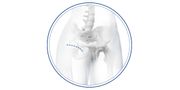 Anterior Minimally Invasive Surgical Hip Replacement Joint (AMIS)