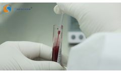 Healgen COVID 19 Antibody Test Instruction - Video