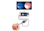 Cystoscopy with the i/Blue Imaging System