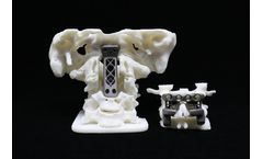 3D Printed Titanium Cage & Plate