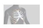 Anatomics StarPore Thoracic Reconstruction - Video
