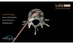 InFill Interbody Fusion Systems - Overview- Pinnacle Spine Group- Video