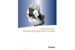 Consensus - Mobile Bearing Knee System - Brochure