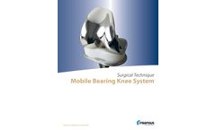 Consensus - Mobile Bearing Knee System - Brochure