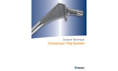 Consensus - Hip System - Brochure 